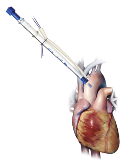 Канюли для искусственного кровообращения Medtronic